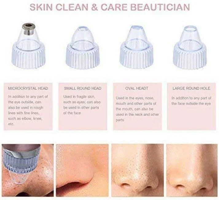 Blackhead Remover Vacuum – Rechargeable Pore Cleaner for All Skin Types