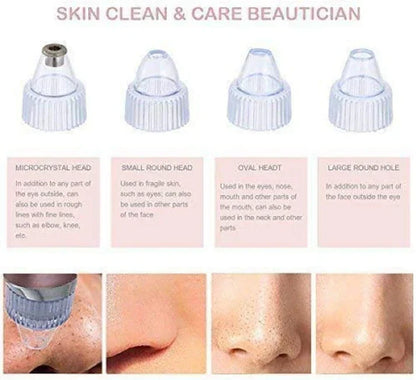 Blackhead Remover Vacuum – Rechargeable Pore Cleaner for All Skin Types